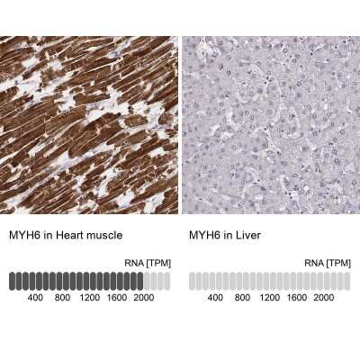 Immunohistochemistry-Paraffin: MYH6 Antibody (CL2148) [NBP2-36744]