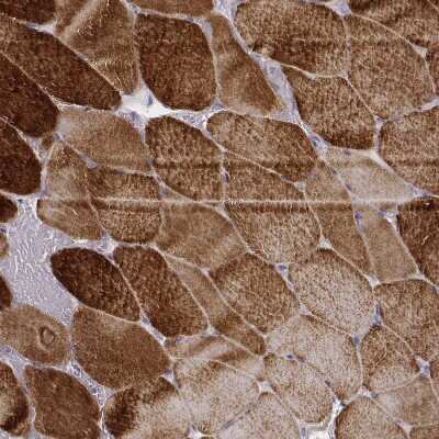 Immunohistochemistry-Paraffin: MYH6 Antibody (CL2155) [NBP2-36745]