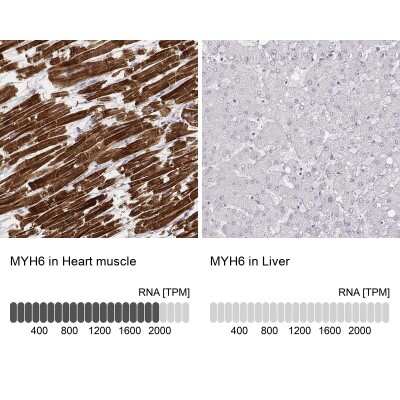 Immunohistochemistry-Paraffin: MYH6 Antibody (CL2155) [NBP2-36745]