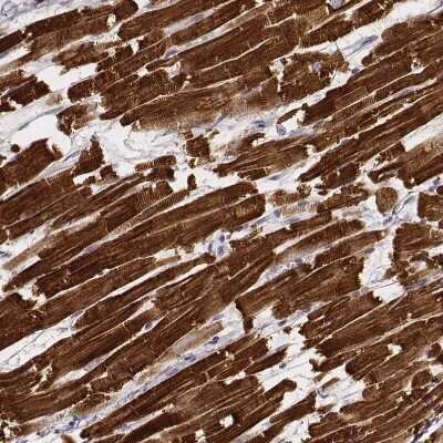 Immunohistochemistry-Paraffin: MYH6 Antibody (CL2162) [NBP2-36746]