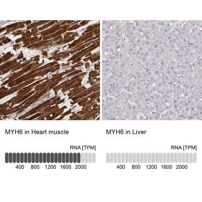 Immunohistochemistry-Paraffin: MYH6 Antibody (CL2162) [NBP2-36746]