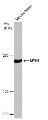 Western Blot: MYH6 Antibody (GT5612) [NBP3-13524]