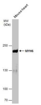 Western Blot: MYH6 Antibody (GT565) [NBP3-13525]