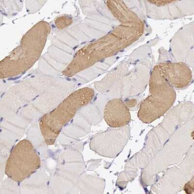Immunohistochemistry-Paraffin: MYH6 Antibody [NBP1-88120]