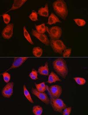 Immunocytochemistry/ Immunofluorescence: MYH7 Antibody - Azide and BSA Free [NBP2-94079]