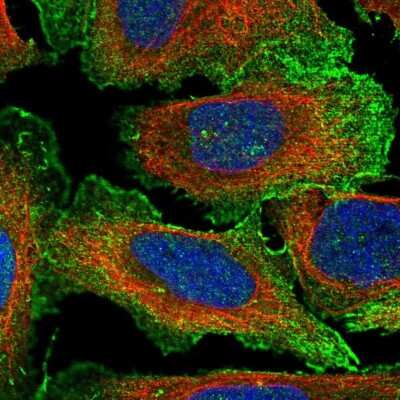 Immunocytochemistry/ Immunofluorescence: MYL4 Antibody [NBP2-30954]