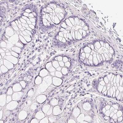 Immunohistochemistry-Paraffin: MYL4 Antibody [NBP2-30954]