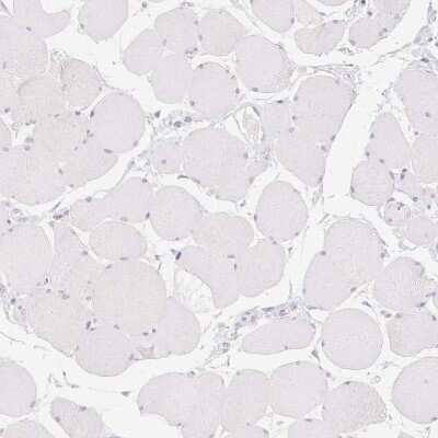 Immunohistochemistry-Paraffin: MYL4 Antibody [NBP2-30954]