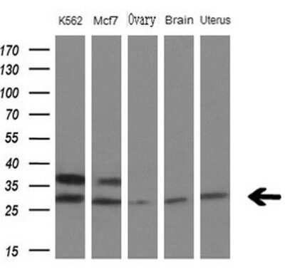 Western Blot: MYL4 Antibody (OTI1H6)Azide and BSA Free [NBP2-72856]