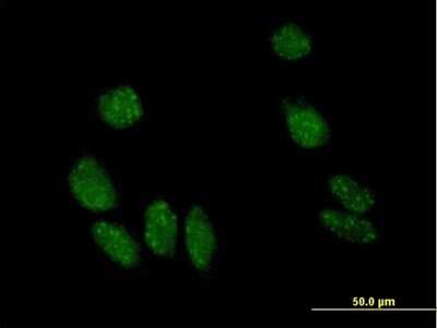 Immunocytochemistry/ Immunofluorescence: MYL5 Antibody [H00004636-B01P]
