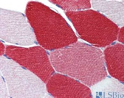 Immunohistochemistry: MYL6 Antibody [NBP1-54376]