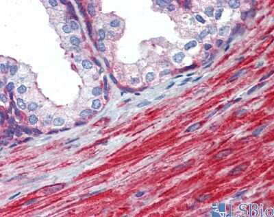 Immunohistochemistry: MYL6 Antibody [NBP1-54376]