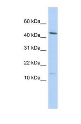 Western Blot: MYL6 Antibody [NBP1-54376]