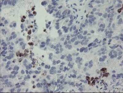 Immunohistochemistry: MYL7 Antibody (OTI4E7) - Azide and BSA Free [NBP2-72859]