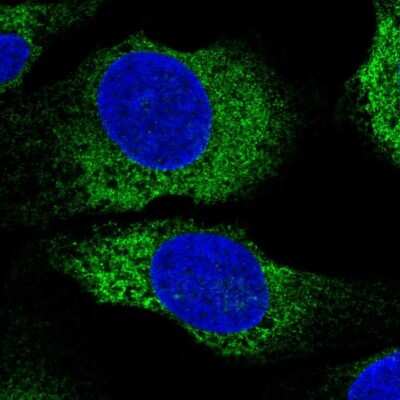 Immunocytochemistry/ Immunofluorescence: MYLK2 Antibody [NBP2-32489]