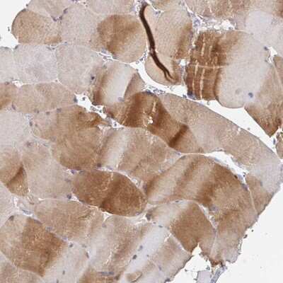 Immunohistochemistry-Paraffin: MYLK2 Antibody [NBP2-32489]