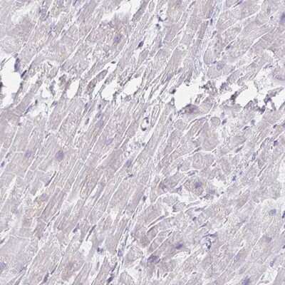 Immunohistochemistry-Paraffin: MYLK2 Antibody [NBP2-32489]