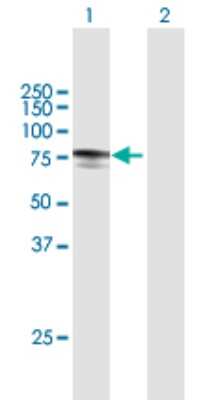 Western Blot: MYLK2 Antibody [H00085366-B01P]
