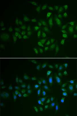 Immunocytochemistry/ Immunofluorescence: MYLK3 Antibody - Azide and BSA Free [NBP2-93604]