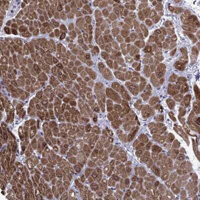 Immunohistochemistry-Paraffin: MYLK3 Antibody [NBP2-62682]