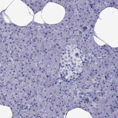 Immunohistochemistry-Paraffin: MYLK3 Antibody [NBP2-62682]