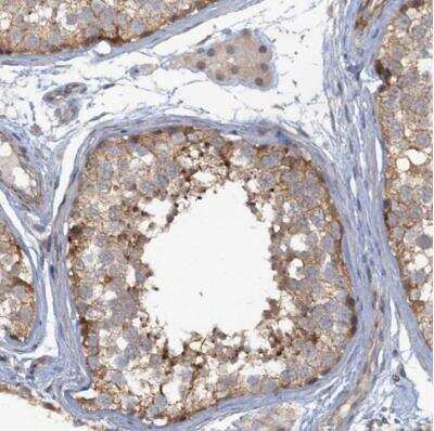 Immunohistochemistry-Paraffin: MYO16 Antibody [NBP1-93617]