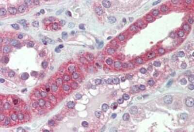 Immunohistochemistry-Paraffin: MYO1H Antibody [NBP2-26205]
