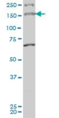 Western Blot: MYO3A Antibody (8D12) [H00053904-M01]