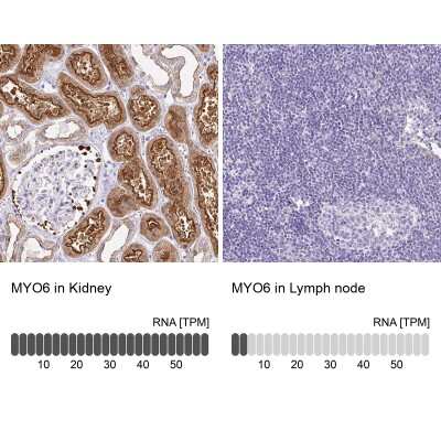 Immunohistochemistry-Paraffin: MYO6 Antibody [NBP2-38254]