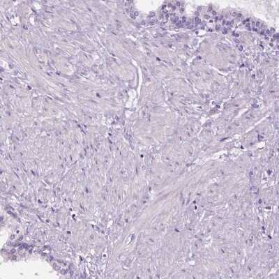 Immunohistochemistry-Paraffin: MYOM1 Antibody [NBP1-86460]