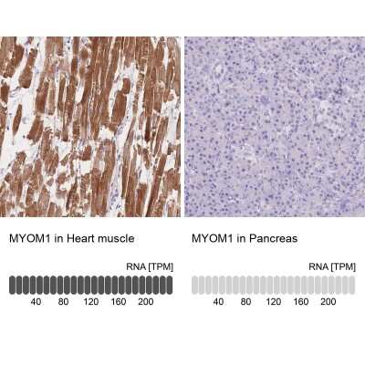Immunohistochemistry-Paraffin: MYOM1 Antibody [NBP2-38603]