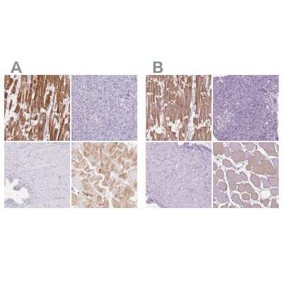 Immunohistochemistry-Paraffin: MYOM1 Antibody [NBP2-38603]