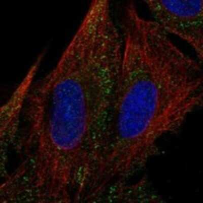Immunocytochemistry/ Immunofluorescence: MYOM3 Antibody [NBP3-17399]