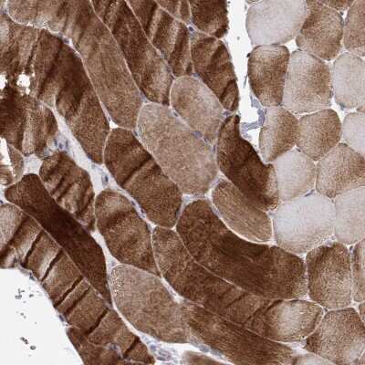 Immunohistochemistry-Paraffin: MYPN Antibody [NBP2-38924]
