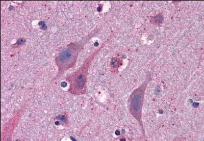 Immunohistochemistry-Paraffin: MYRIP Antibody [NB100-1278]