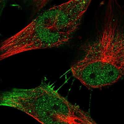 Immunocytochemistry/ Immunofluorescence: MYSM1 Antibody [NBP2-57859]