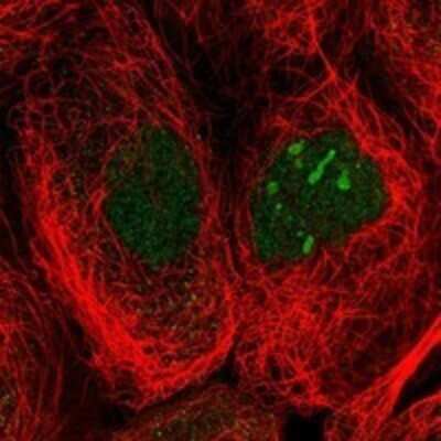 Immunocytochemistry/ Immunofluorescence: MYSM1 Antibody [NBP3-17396]