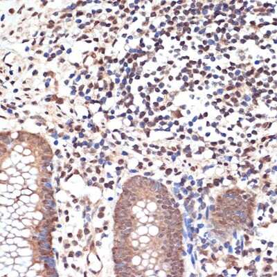 Immunohistochemistry-Paraffin: MYST1 Antibody (6U5Z6) [NBP3-16178]