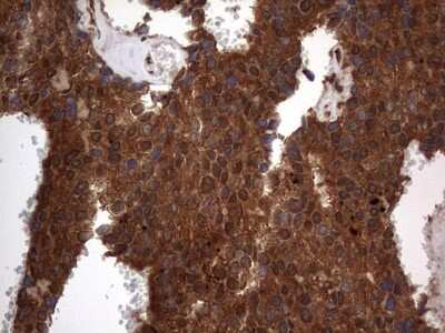 Immunohistochemistry: Macro H2A.2 Antibody (OTI1C2) [NBP2-45930]
