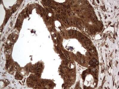 Immunohistochemistry: Macro H2A.2 Antibody (OTI1C2) [NBP2-45930]