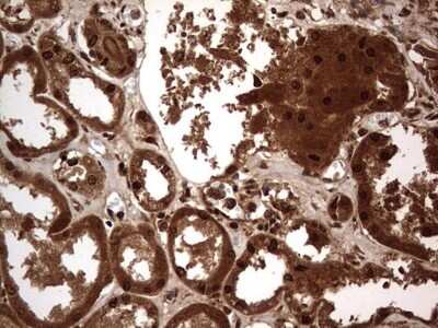 Immunohistochemistry: Macro H2A.2 Antibody (OTI1C2) [NBP2-45930]