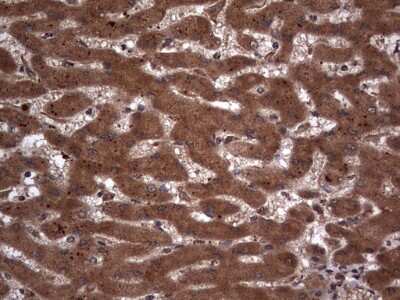 Immunohistochemistry: Macro H2A.2 Antibody (OTI1C2) [NBP2-45930]
