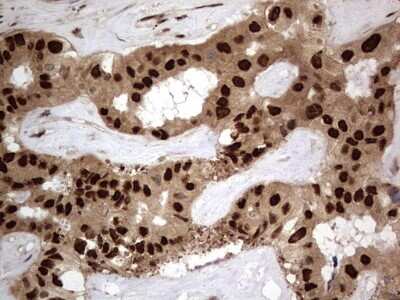 Immunohistochemistry: Macro H2A.2 Antibody (OTI1C2) [NBP2-45930]