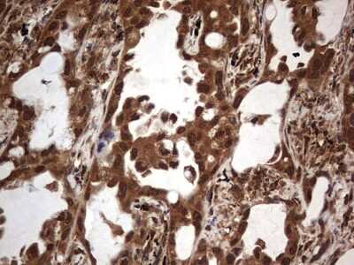Immunohistochemistry: Macro H2A.2 Antibody (OTI1C2) [NBP2-45930]