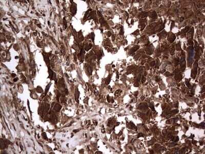 Immunohistochemistry: Macro H2A.2 Antibody (OTI1C2) [NBP2-45930]