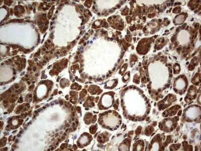 Immunohistochemistry: Macro H2A.2 Antibody (OTI1C2) [NBP2-45930]