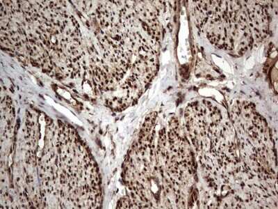 Immunohistochemistry: Macro H2A.2 Antibody (OTI1C2) [NBP2-45930]