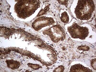 Immunohistochemistry: Macro H2A.2 Antibody (OTI1C2) [NBP2-45930]