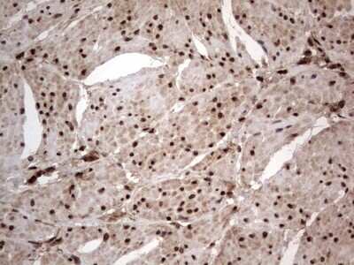 Immunohistochemistry: Macro H2A.2 Antibody (OTI1C2) [NBP2-45930]
