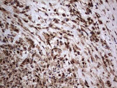 Immunohistochemistry: Macro H2A.2 Antibody (OTI1C2) [NBP2-45930]